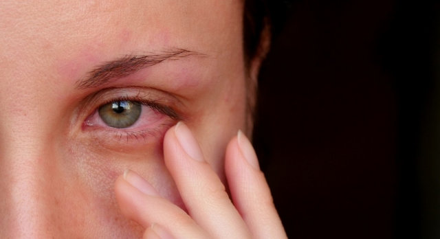 Common Eye Injuries and Their Treatment - 2